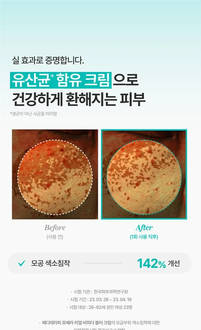 [바르고 자는 톤업크림] 메디테라피 포쎄라 리얼 비피다 블러 크림 50ml 상세페이지 14